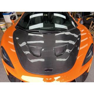 Karbonová kapota McLaren 540C/570S 2015–2020 fotografie 2